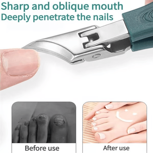 🔥Dernier jour de vente 50 % de réduction - Eagle Beak Angled Nail Clippers Set de 3 pièces