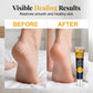 Crème hydratante réparatrice anti-crevasses pour les pieds